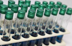 provette per analisi di laboratorio