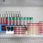 Listeria monocytogenes: contaminazione, sopravvivenza e sviluppo negli alimenti