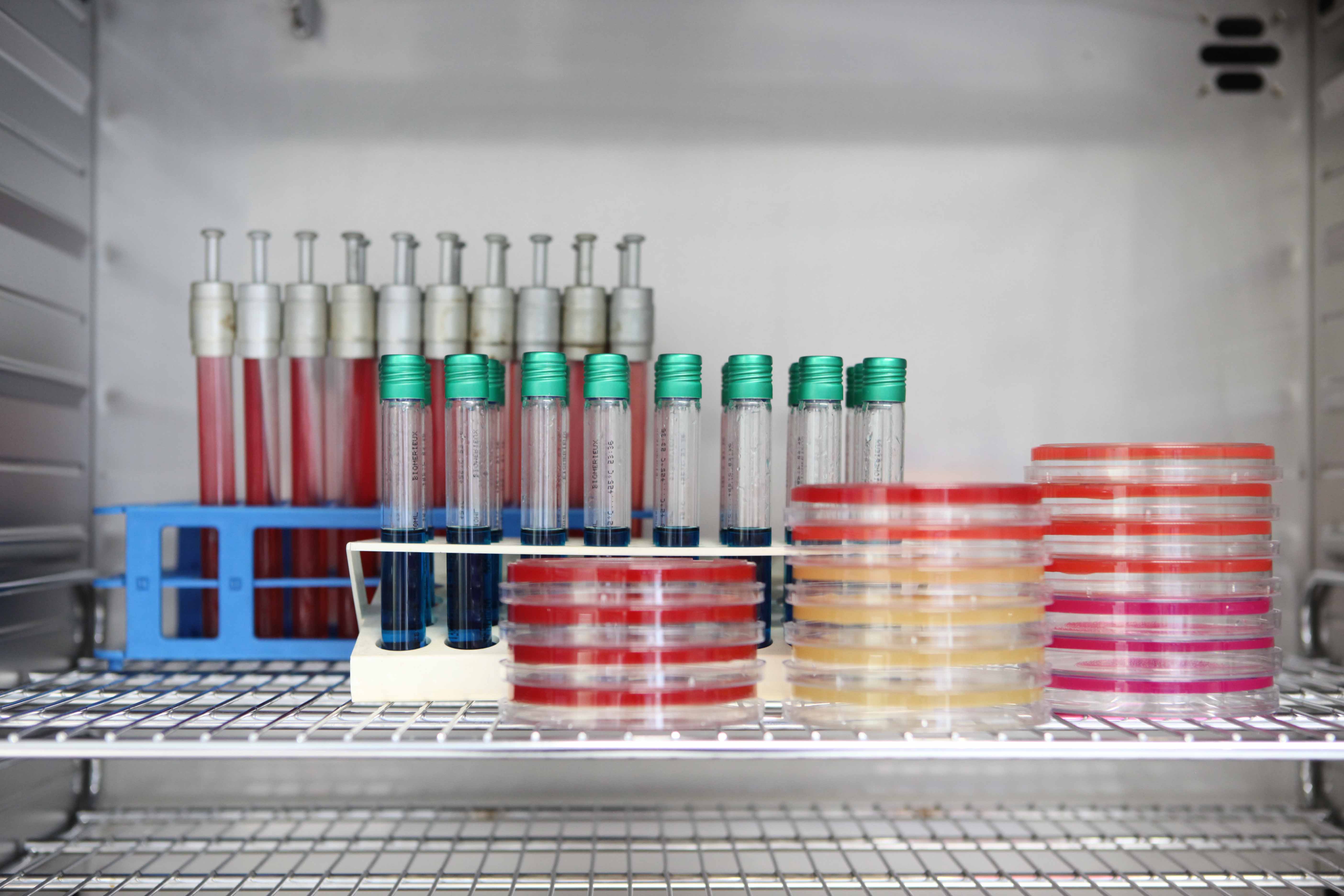 Listeria monocytogenes: contaminazione, sopravvivenza e sviluppo negli alimenti